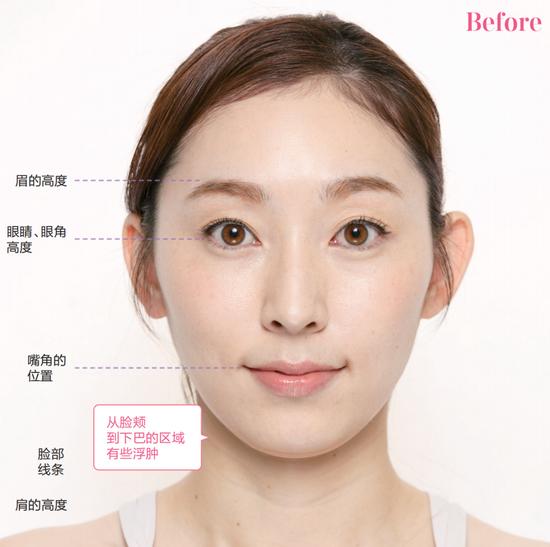 脸肿怎么按摩可以消肿__脸浮肿怎么按摩